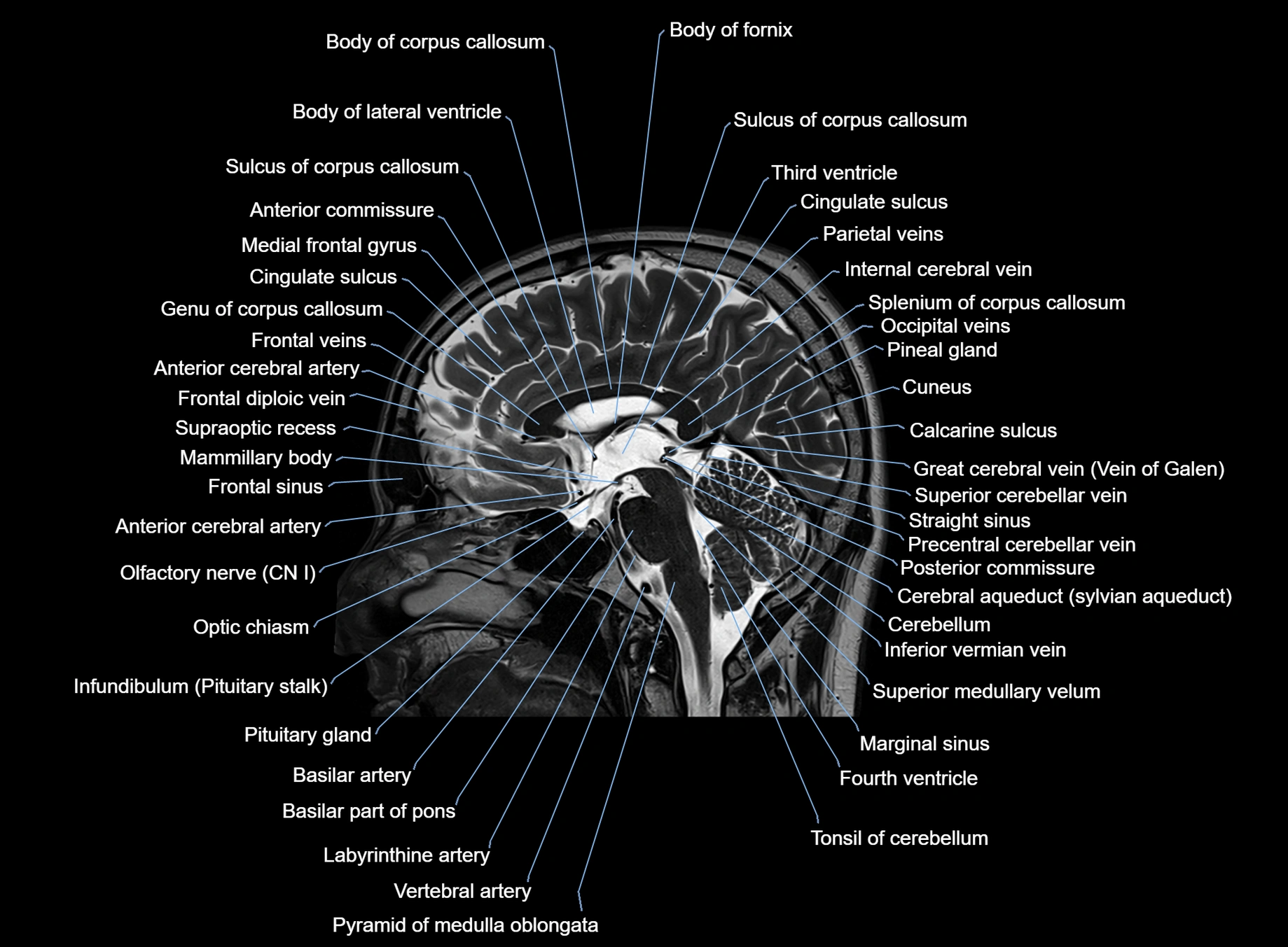 brain sagittal anatomy 3T MRI images -img-00001-00034.webp